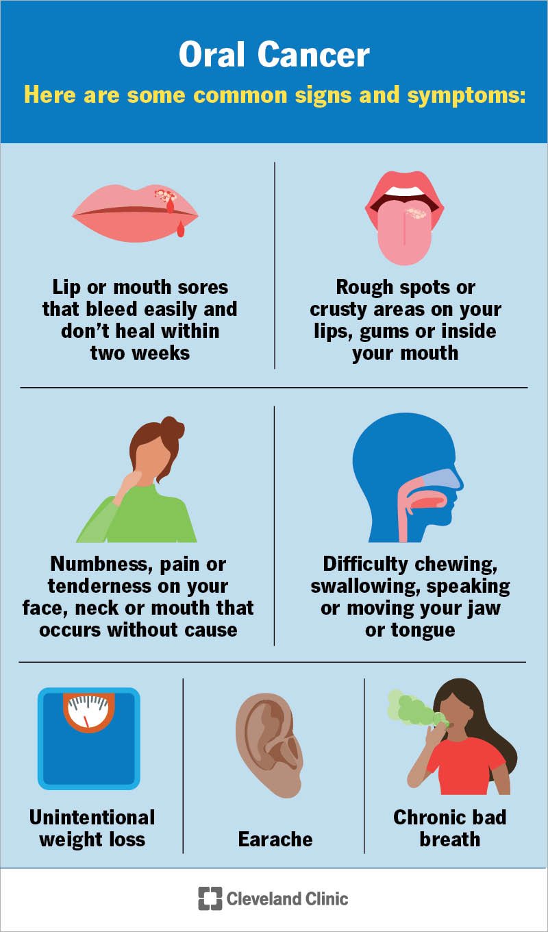 Bump on Roof of Mouth Causes, Symptoms, and Treatment Options Bloomsies