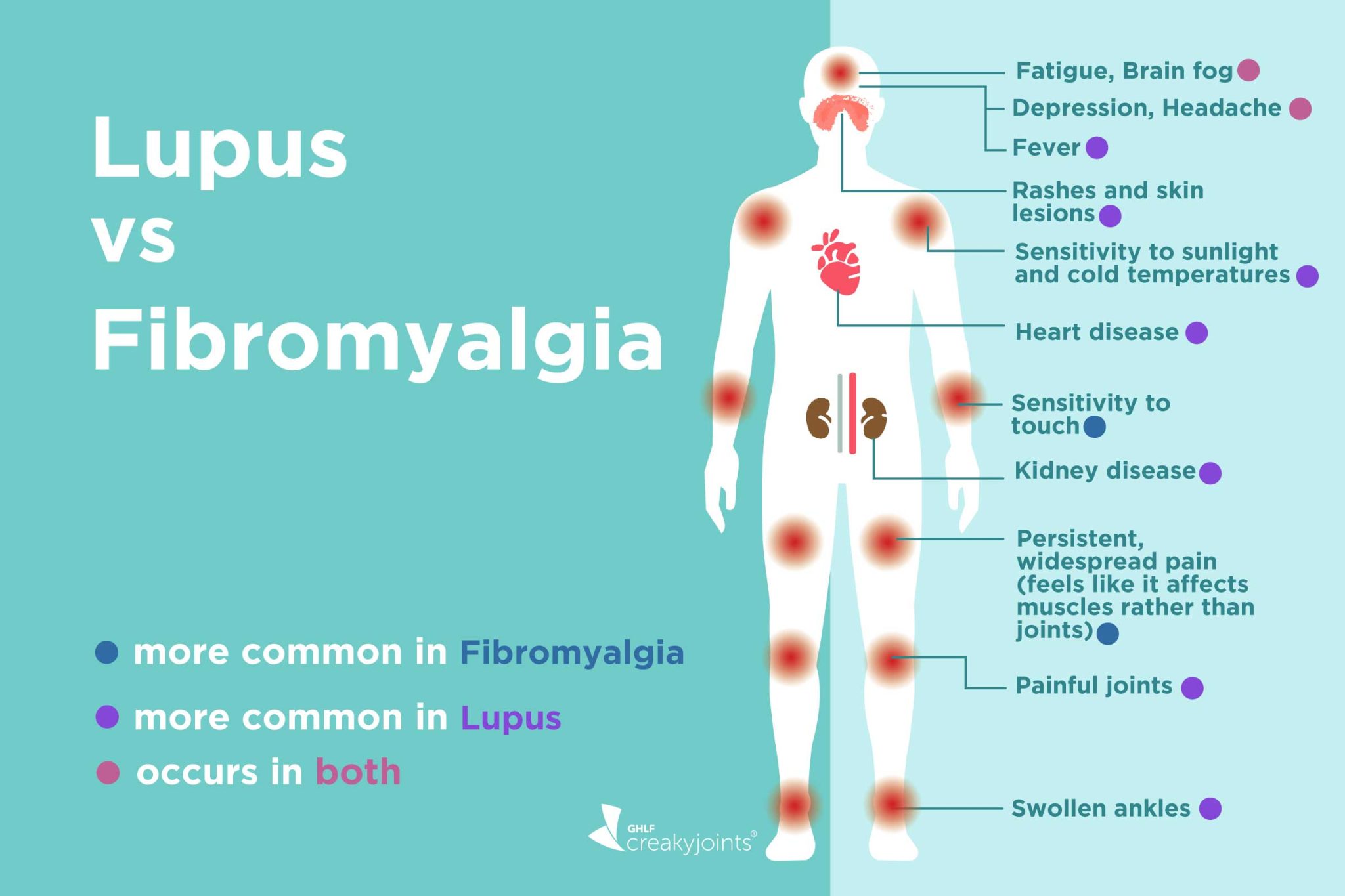 Fibromyalgia Rash: Understanding the Connection Between Skin and Pain ...