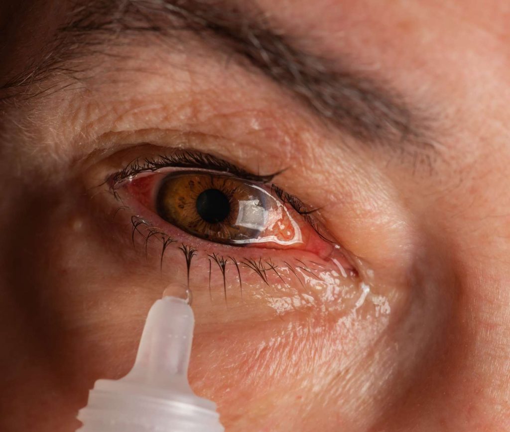 Polytrim Eye Drops A Powerful Solution for Eye Infection Treatment