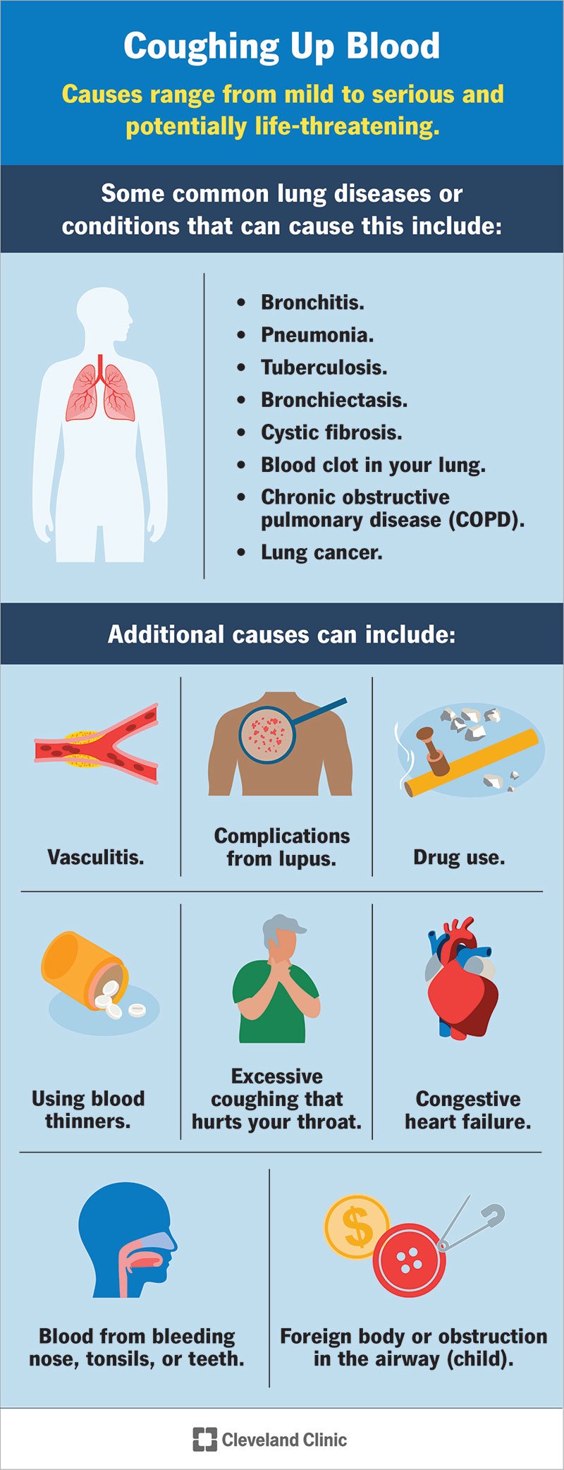 throwing-up-mucus-causes-symptoms-and-treatments-bloomsies