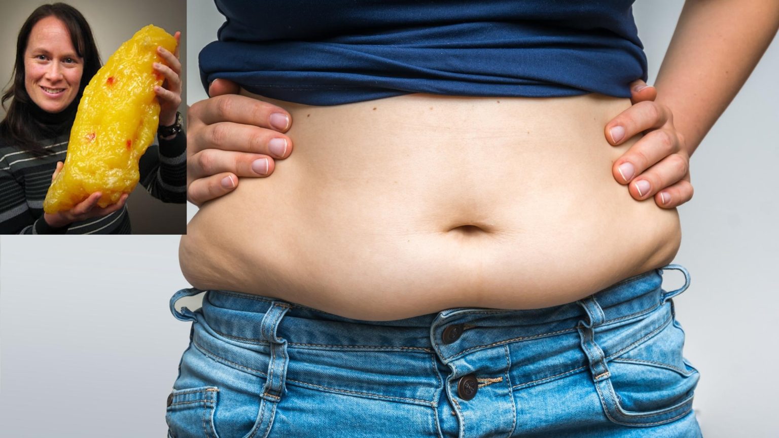 What Does 20 Pounds Of Fat Look Like On Your Body Bloomsies