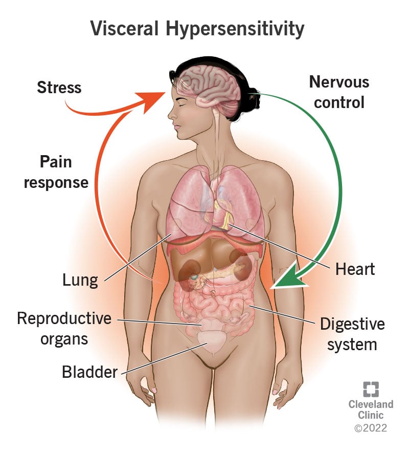 chronic-diarrhea-what-it-is-causes-treatment-options